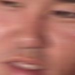 ホモ(悪性)