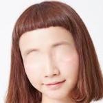 前髪ハゲ